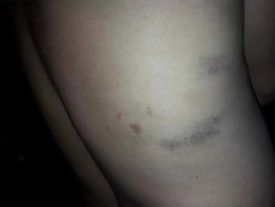 joven golpeado II.jpg