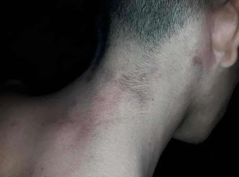 joven golpeado.jpg