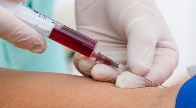extraccionsangre.jpeg