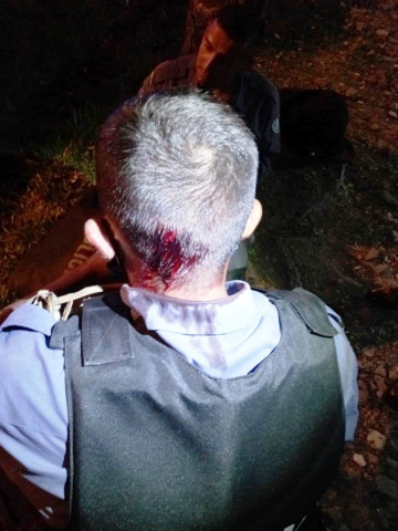 Policiales lesionados en intervencion barrio La Floresta (1).jpg